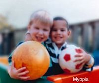 human_eyesight_two_children_and_ball_with_myopia